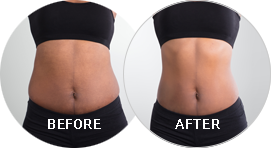 before and after picture