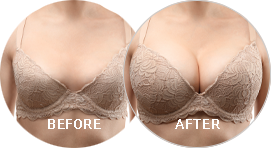before and after picture