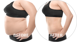 before and after picture